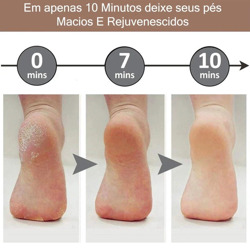 Lixador Elétrico Profissional – Pés Lisos em Minutos!